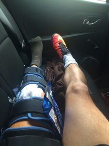 knee after operation
